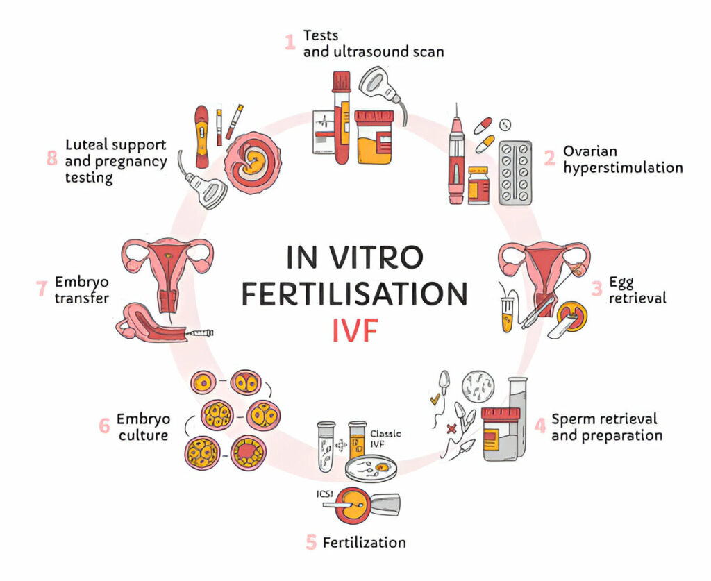 IVF process step by step