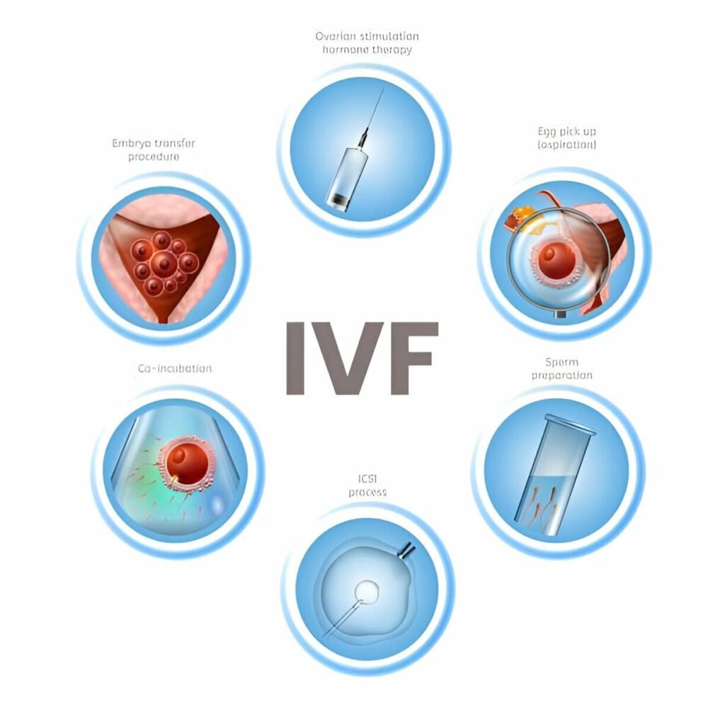 How do IVF doctors do IVF treatment in Siliguri